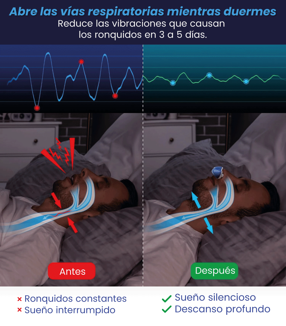 Dispositivo Antirronquidos Inteligente - SleepAir Max®